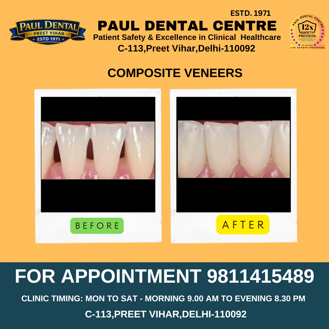 Case 28 – Paul Dental Center